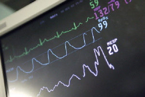 Research into fatal heart condition has identified potential therapeutic enzyme