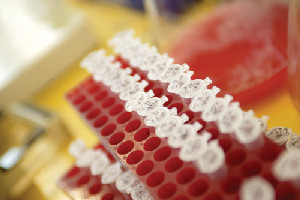 Manchester scientists have found evidence of a genetic link to intelligence