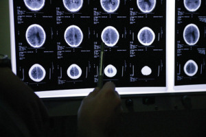 An image of brain scans