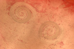 Trichinella spiralis nurse cells in muscle