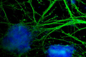 Neural projections from mouse embryonic stem cells cultured on the scaffolds