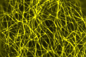 Mutant bot1-7 pavement cells cannot organise their microtubules