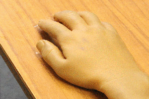A prosthetic hand which some people find eerie