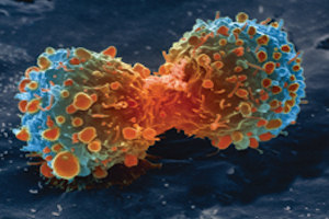 Lung cancer cell