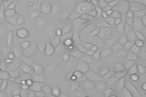 Pancreatic cancer cells