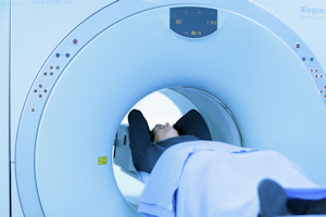 PET imaging is widely used in the management of cancer patients