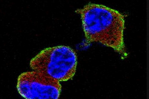 Insulin-secreting cells