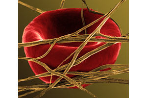 Healthy red blood cell in fibrin fibres