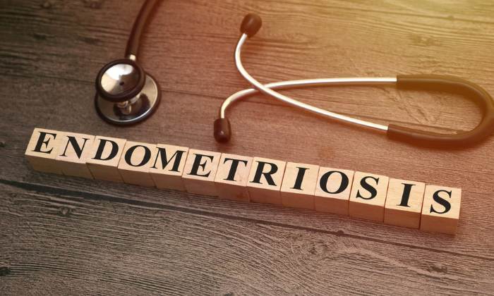 Endometriosis spelled out in wooden cubes, with a stethoscope